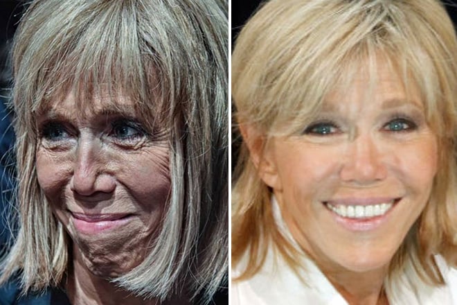 Brigitte Macron before and after plastic surgery
