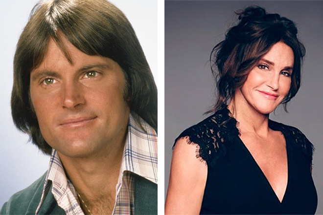Caitlyn Jenner before and after the surgery