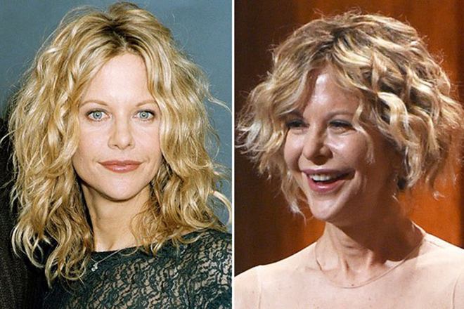 Supposed plastic surgery of Meg Ryan (before and after)