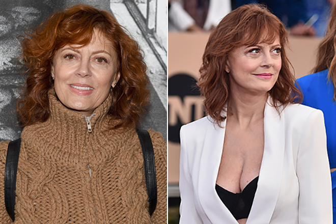 Susan Sarandon before and after the plastic surgery