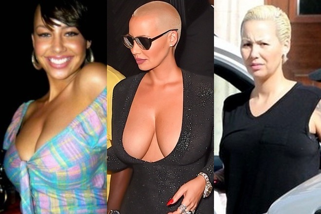 Amber Rose before and after breast surgery