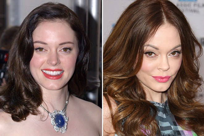 Rose McGowan before and after plastics