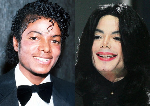 Michael Jackson befor and after surgery