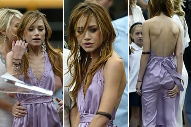 Mary-Kate Olsen suffered from anorexia