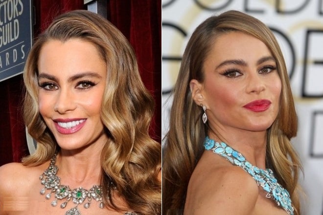 Sofía Vergara before and after plastic surgery
