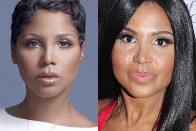 Toni Braxton before and after the surgery