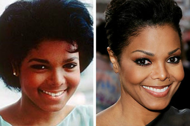 Janet Jackson before and after rhinoplasty