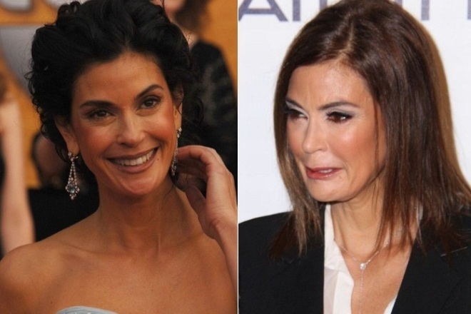 Teri Hatcher before and after plastic surgery