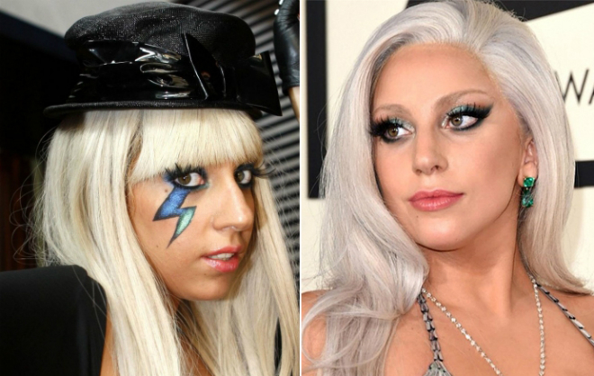 Lady Gaga before and after plastic surgery