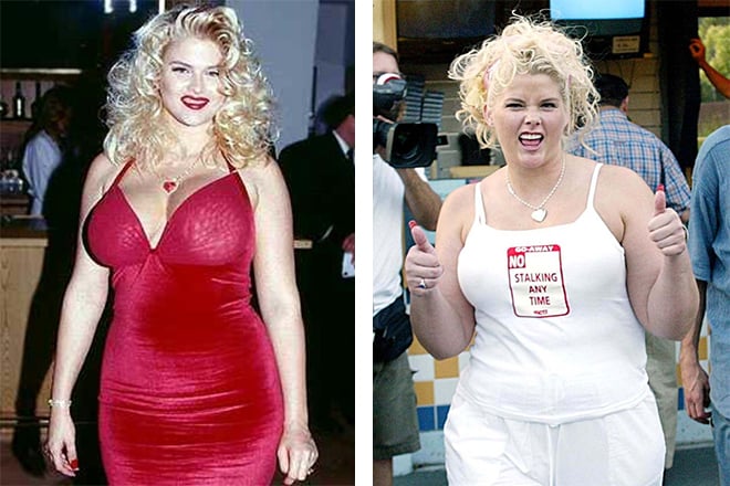 Anna Nicole Smith gained excess weight