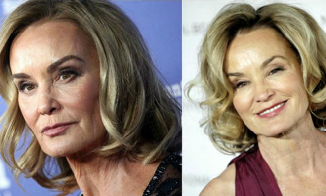 Jessica Lange before and after plastic surgery procedures