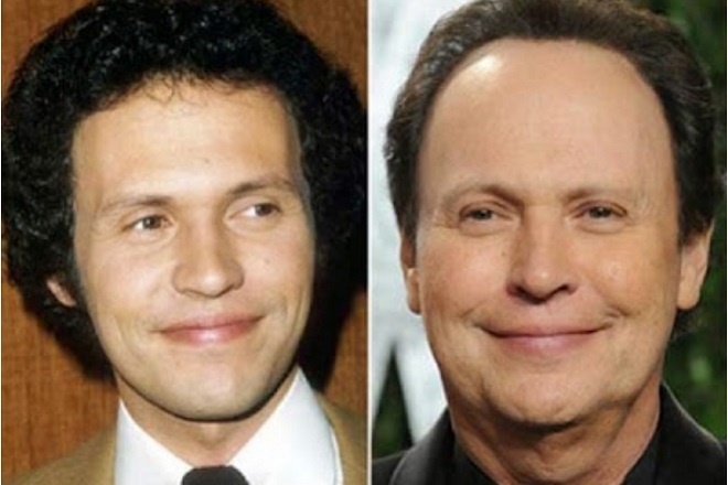 Billy Crystal befor and now