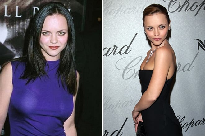 Christina Ricci before and after breast reduction surgery