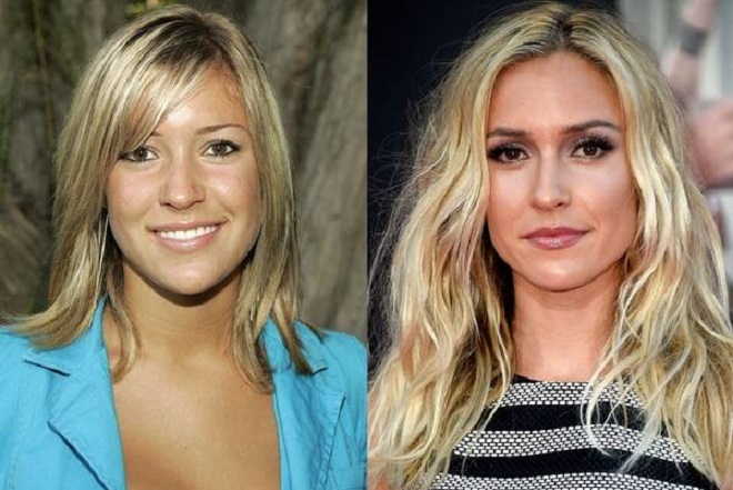 Kristin Cavallari from The Hills Then and Now