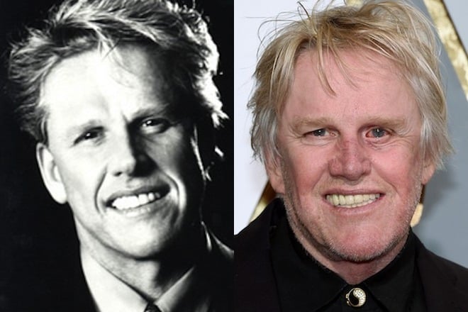 Gary Busey before and after the accident