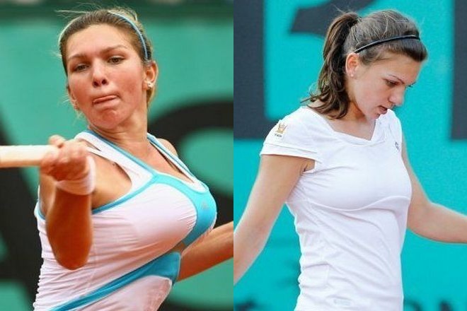 Simona Halep before and after breast plastic surgery
