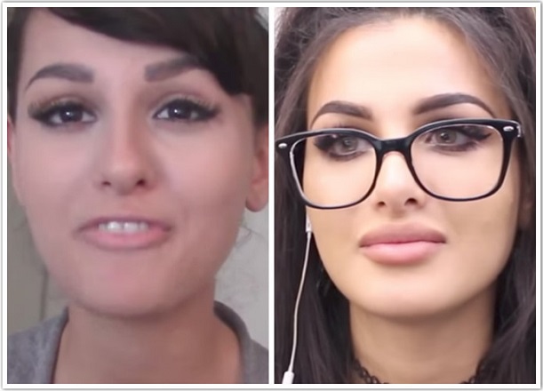 SSSniperWolf, before and after plastic surgery