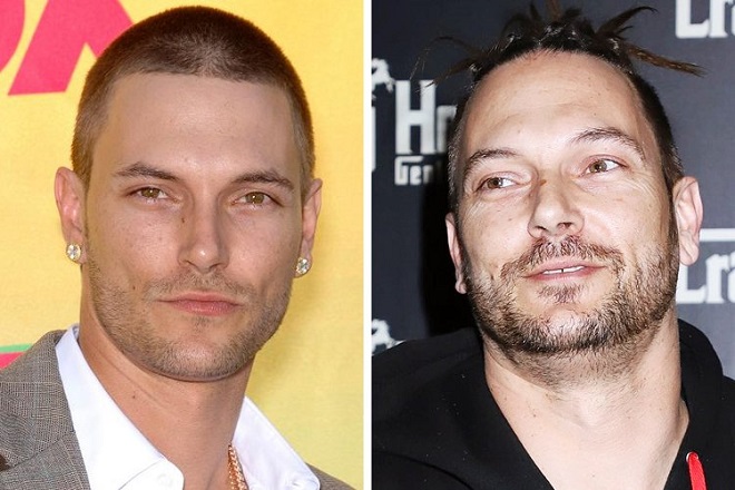 Kevin Federline: Then and Now