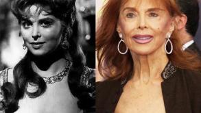 Hollywood's Plastic Surgery Confessions: 10 Celebs Who Went Under the Knife!